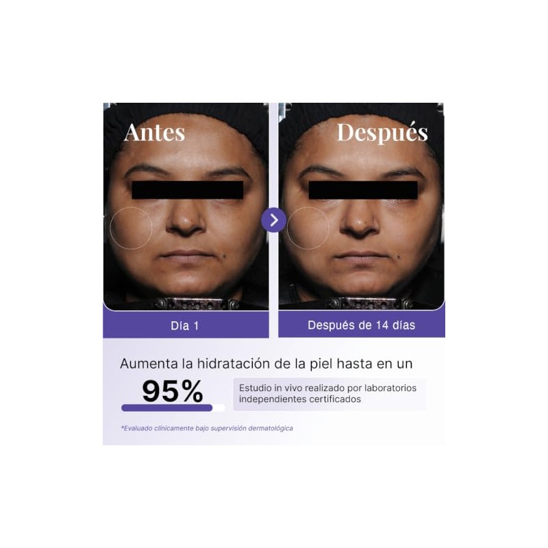 Sérum Facial Ácido Hialurónico 2% con Betaína, 30 ml
