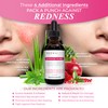 Dermaced Redness Redux Advanced Rosacea & Skin Redness Serum, 1