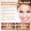 generic 14 Piezas De Gel Dental Para Restauración