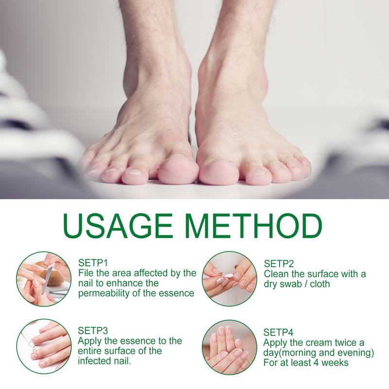 Fix Gray Nails Fast! Jaysuing Ginger Nail Repair Solution –