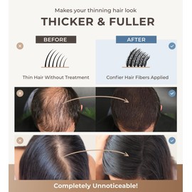 CONFIERR CONFIERR Keratin Hair Fibers for Men & Women - Fill In Fine or Thinning Hair, Instantly Thicker, Fuller Looking Hair (Medium Brown 30g)