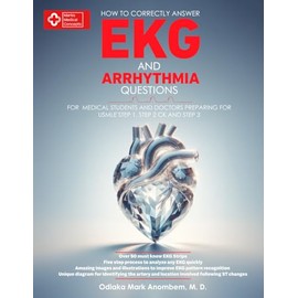 How to Correctly Answer EKG and Arrhythmia Questions: For Medical Students and Doctors Preparing for USMLE Step 1, Step 2 CK, and Step 3