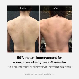 Medicube Gel De Baño Red Acné Limpiador Hidratante Y Ph Bajo