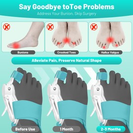QDAVE Bunion Corrector for Women and Men Big Toe,Adjustable Knob Bunion Splint, For Bunion Relief, Toe Straightener Device with Silicone Bunion Pad, Suitable for Left/Right Feet
