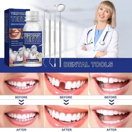 Temporary Tooth Filling,Temporary Teeth Replacement Kit,False Teeth Replacement Tooth Filling Repair Kit,Replace with False Teeth and Filler,Temporary Dental Filling Kit,Tooth Repair Kit