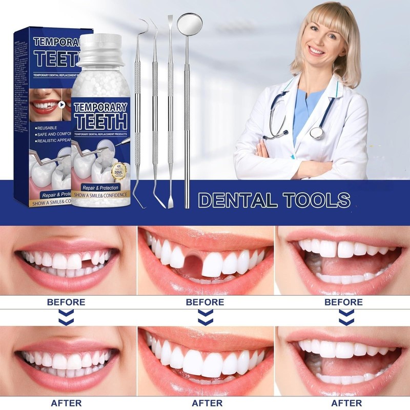 Temporary Tooth Filling,Temporary Teeth Replacement Kit,False Teeth Replacement Tooth Filling
