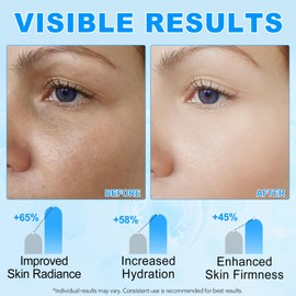 Hyaluronic Acid Powder, Hyaluronic Acid Powder, High-Quality Hyaluronic Acid Powder, Hyaluronic Acid Serum Powder, Instant Moisture Supply for Dry and Sensitive Skin