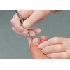 Kosmetex 2 x tamponade for toenails and the nail fold,