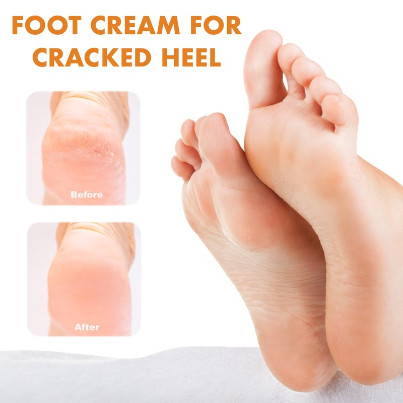 Foot Cream – Honey & Vitamin E Moisturizer, Cracked Heel