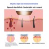 Lomxe Dispositivo De Máquina De Depilación Láser Permanente De Dep