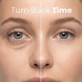 LIVAURA Retinol Under Eye Patches for Women - Eye Masks for Dark Circles