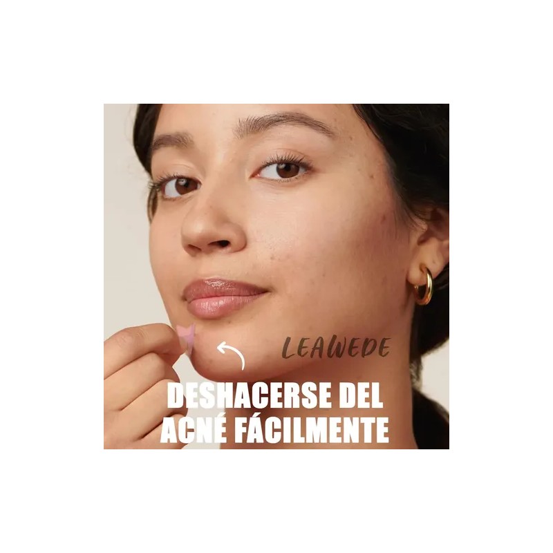 240pzs Mascarillas Estrella Para El Acne Espinillas Granos