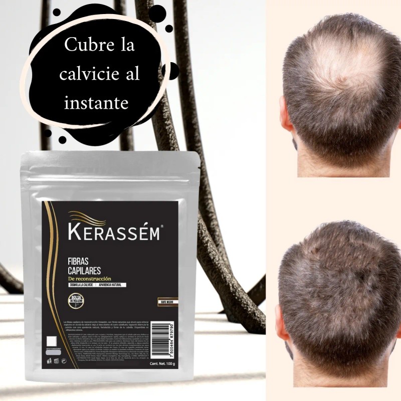 Fibras Capilares 100g Cubre Calvicie Kerassém Varios Tonos