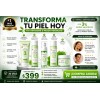 Kit Skincare Antiacné Vogirlog 5 Pasos Control Grasa
