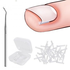 40 Pcs Ingrown Toenail Correction Strips, Toenail Straightener Strips, with Toenail Lifter, Ingrown Toenail Treatment Kit, Toenail Recover Clips, for Women Men Foot Care