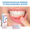 Hyalugel Forte Mouth Gel 8ml