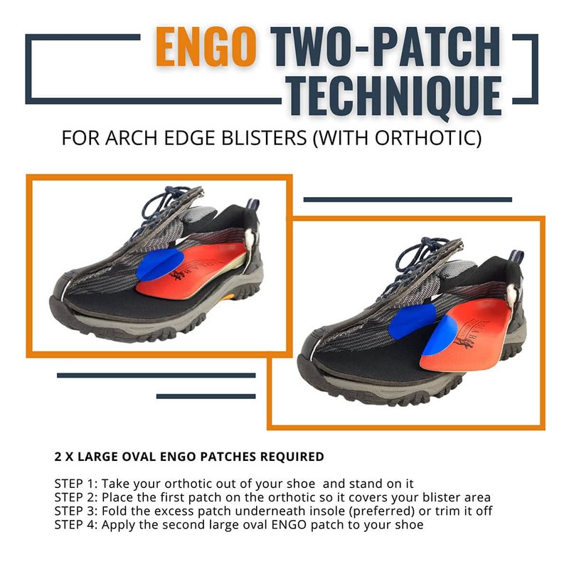 ENGO Blister Prevention Patches x 2 Large Ovals