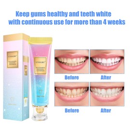 Niacinamide Whitening Toothpaste, Utogru Teeth Radiant Whitening Toothpaste - Enamel Care, Repair and Protect Teeth, Fresh Breath (2Pcs
