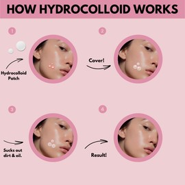 Hydrocolloid Invisible Spot Cover Patch - Absorbing Cover, Skin Care, Facial Stickers, 2 Sizes (108 Count)