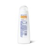Dove DermaCare Scalp Anti Dandruff Shampoo for Dry and Itchy