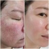 Kit De Viaje Riman Skincare Coreano - Rutina Completa
