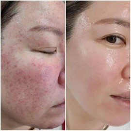 Kit De Viaje Riman Skincare Coreano - Rutina Completa