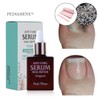 Buzel Viewgel Pedibene Antipung Original 10ml nail art material for
