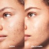CLEANSER BB ACNE CLARIFYING