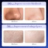 Cleansing mask! Star Rip-Off Mask Adsorbent Blackhead & Acne Exfoliating