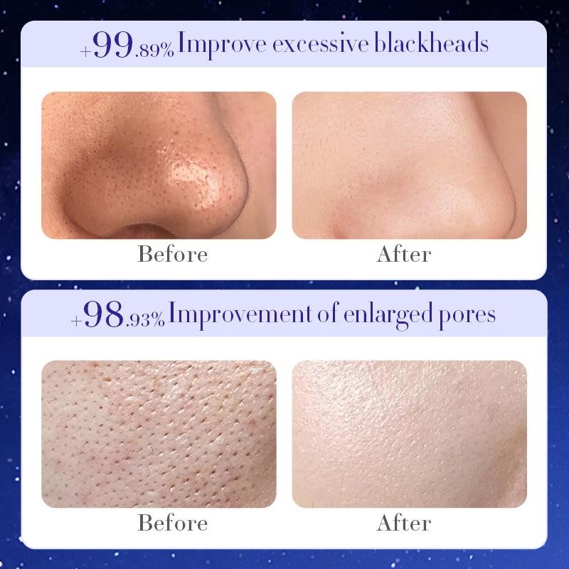 Cleansing mask! Star Rip-Off Mask Adsorbent Blackhead & Acne Exfoliating