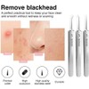 Professional Stainless Steel Blackhead Remover Kit - 3Pcs Precision Pimple