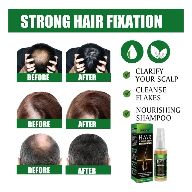 El Sérum Para El Crecimiento Del Cabello Promueve El Crecimi
