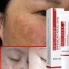 Crema Facial Despigmentante Y Anti Manchas Pack 2 Pzs Todo