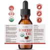 BodyJ4You BodyJ4You Rosehip Oil for Face - 100% Pure Natural