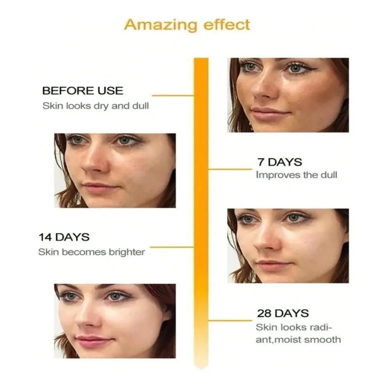 Crema Quitamanchas Hidratante 20g Para Rostro Todo Tipo De Piel
