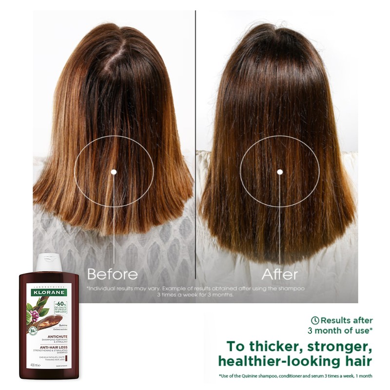 KLORANE [ANTI-HAIR LOSS] Quinine Shampoo (400ml) - For Thinning Hair