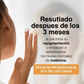 Repigment12 Tratamiento Para Pieles Con Hipopigmentacion Momento de aplicación Día/Noche Tipo de piel Todo tipo de piel