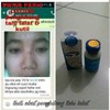 ( READY STOCK ) Swiss paris lotion penghilang kutil tahi