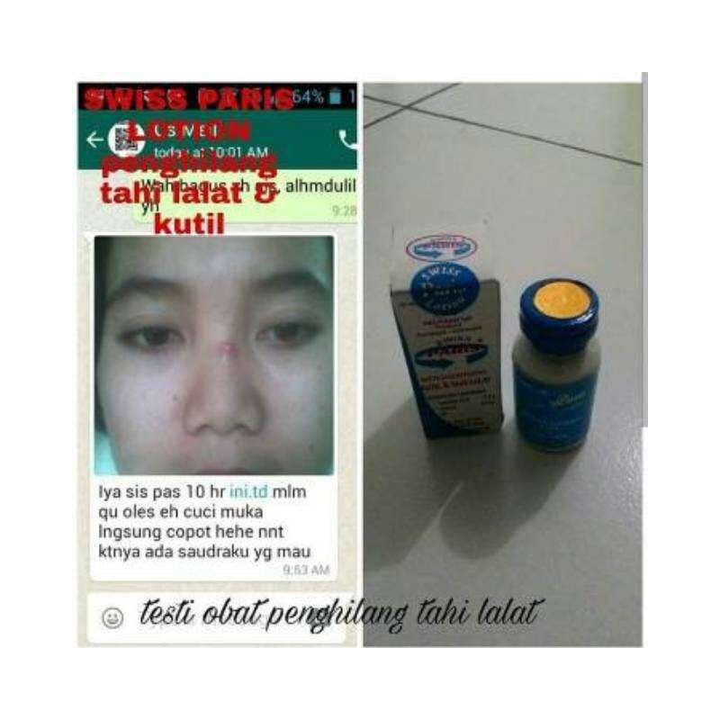 ( READY STOCK ) Swiss paris lotion penghilang kutil tahi