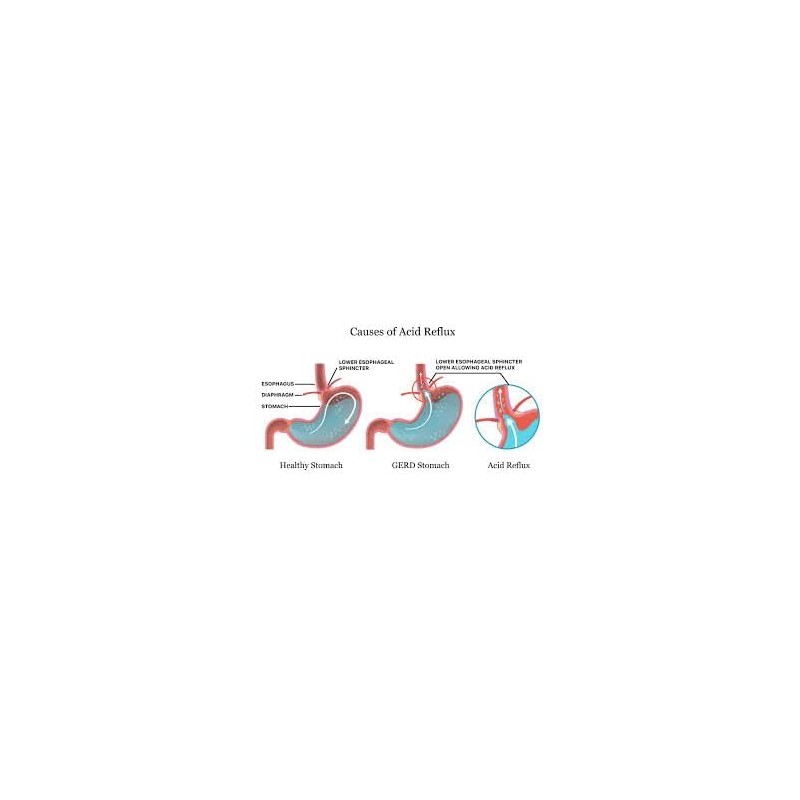 Melox for Heartburn Relief