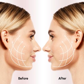 Avantic Turkey Neck Tightener for Women V Line Face Slimming Strap for Double Chin