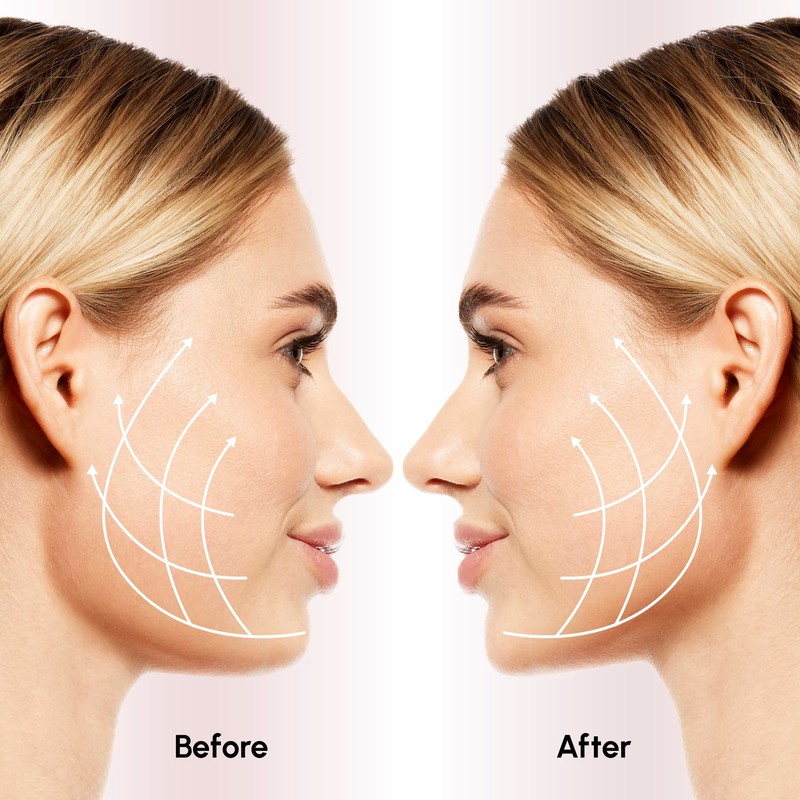 Avantic Turkey Neck Tightener for Women V Line Face Slimming