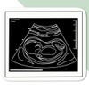4 x Small 50mm 'Ultrasound Baby Photo' Permanent Sticker Decals
