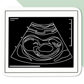 4 x Small 50mm 'Ultrasound Baby Photo' Permanent Sticker Decals for Cars/Windows/Bins/Walls etc (DW00136736)