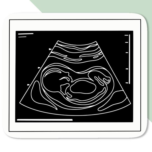 4 x Small 50mm 'Ultrasound Baby Photo' Permanent Sticker Decals