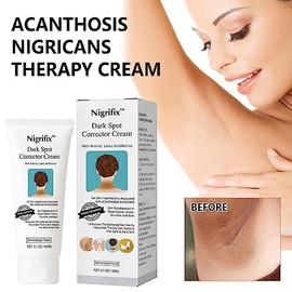 Acanthosis Nigricans Crema, Crema Correctora de Manchas Oscuras,- Axilas, Cuello, Axilas, Rodillas, Codos, Zonas Privadas, Zonas Íntimas - Fórmula Mej
