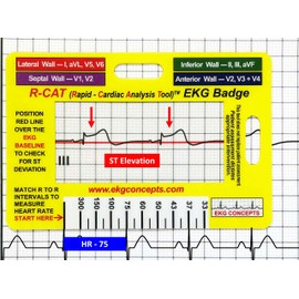 R-CAT EKG Badge