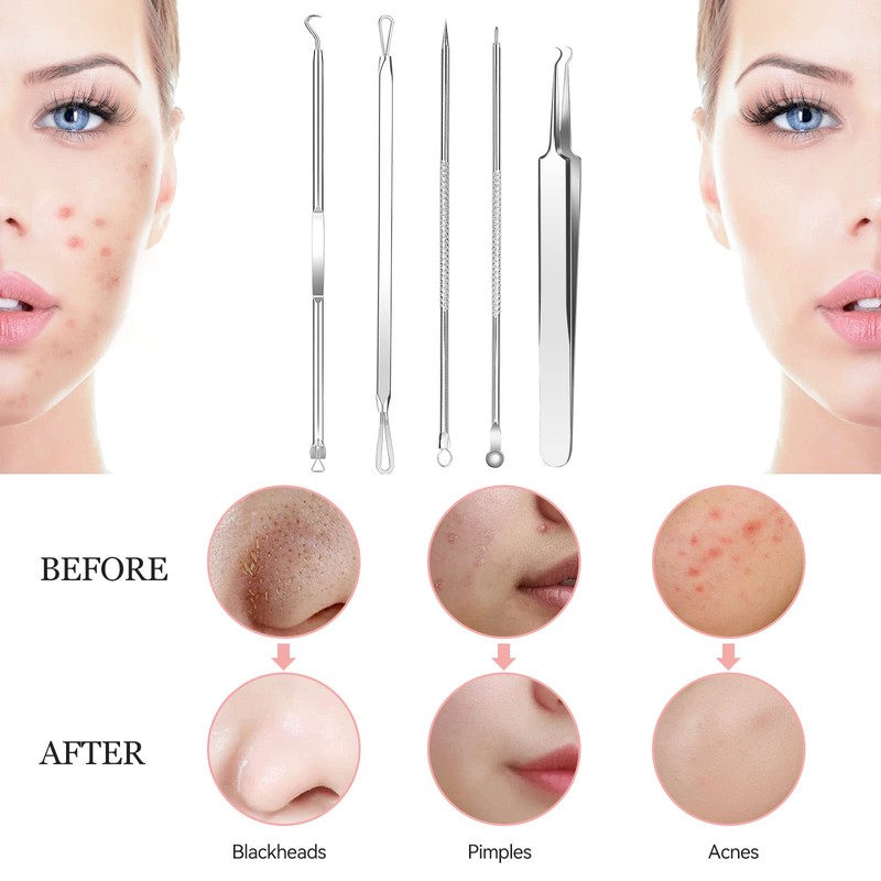 Whitehead Blemish Removal Tool Pimple Popper Tool Kit 8 Pcs