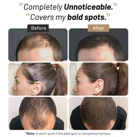 CONFIERR Hair Fibers for Men & Women (15 Grams, Medium Brown) - Fill In Fine Hair for Instantly Thicker, Fuller Looking Hair