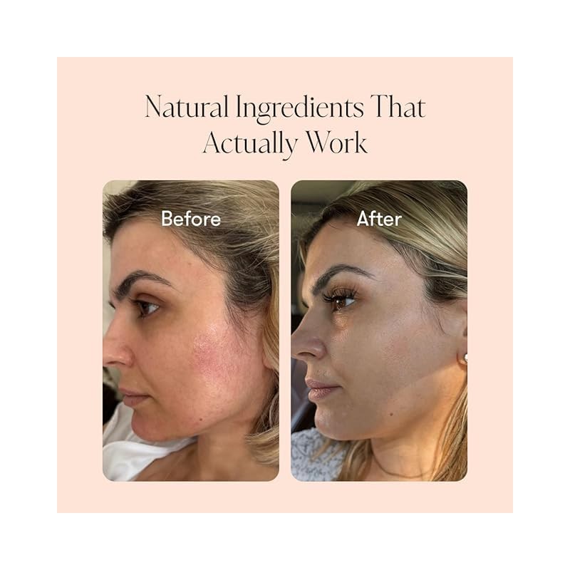 KUSHI Grass-Fed Whipped Tallow Cream Moisturizer for Face & Body